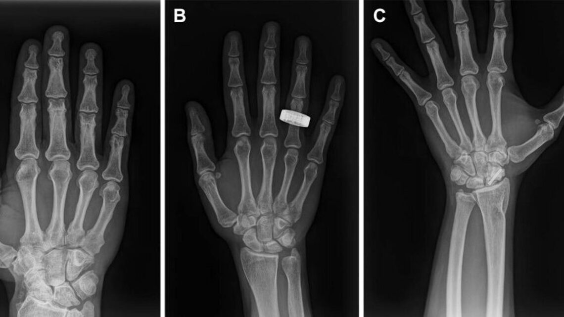 Medical X-rays taken in space for the first time