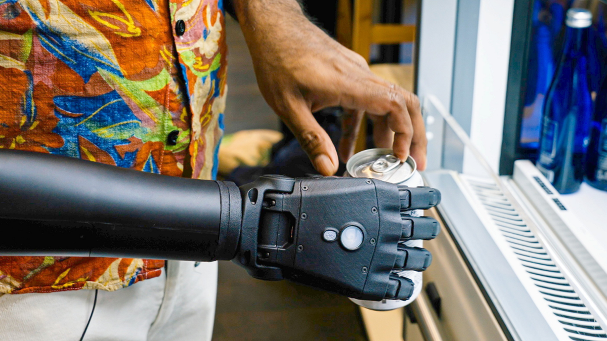 (Open Bionics via SWNS). 