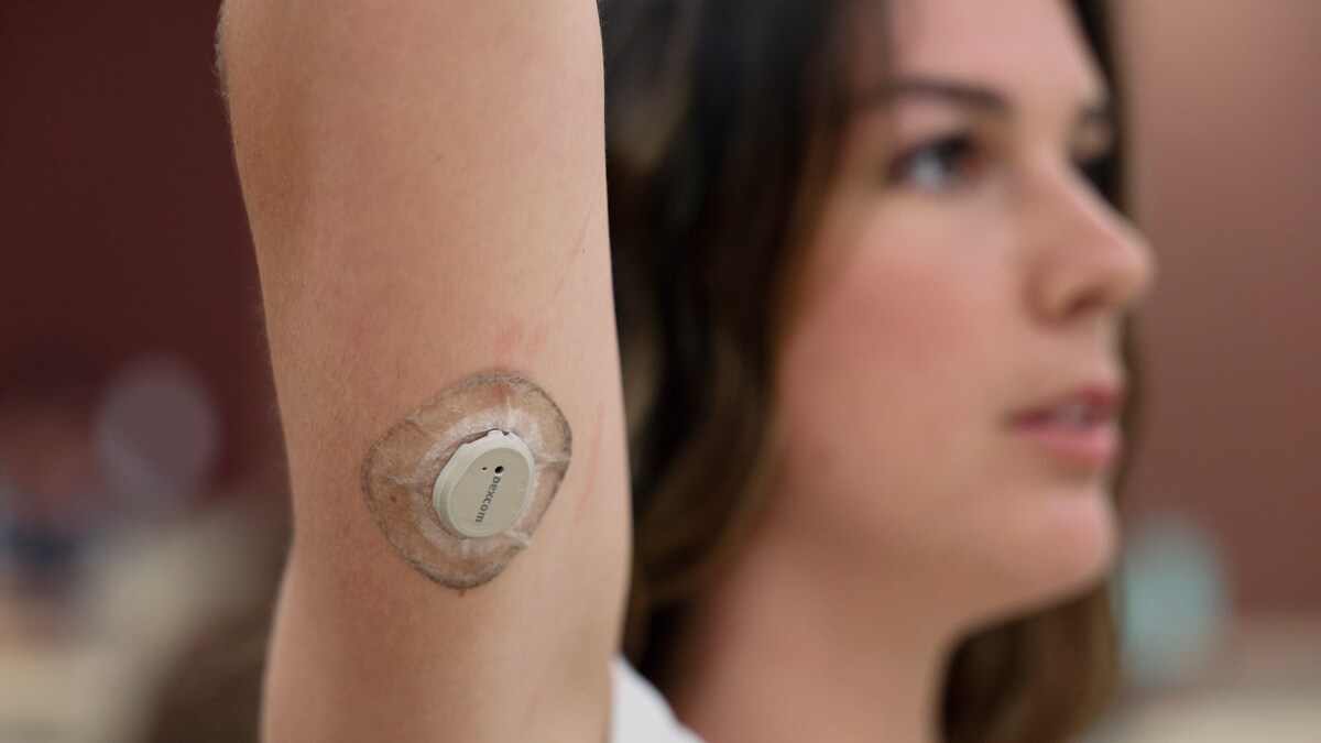 Student Rylan Breneman shows her Dexcom glucose monitor while attending the Metabolic Health Analytics class at UCSD in La Jolla on Tuesday, June 02, 2026. (Hayne Palmour IV / For The San Diego Union-Tribune)