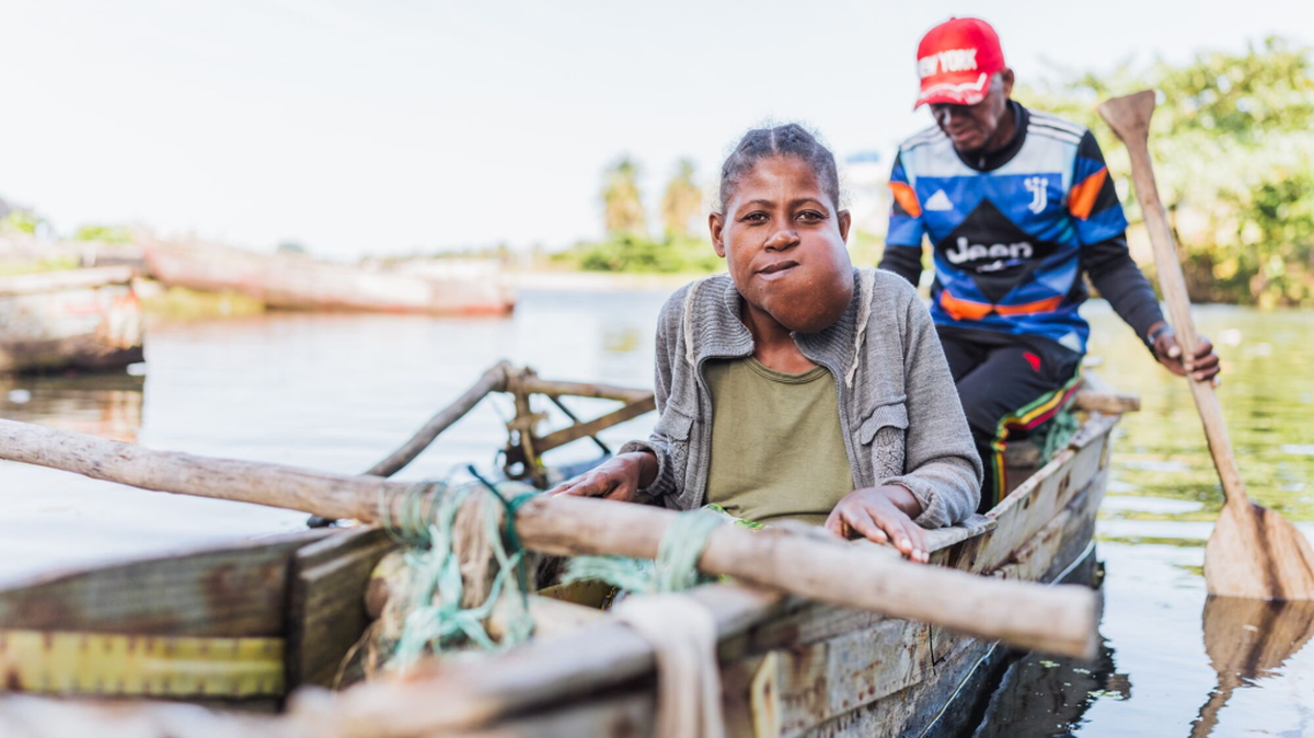 Theogette, 50, lived with the tumor for years. (Mercy Ships via SWNS). 