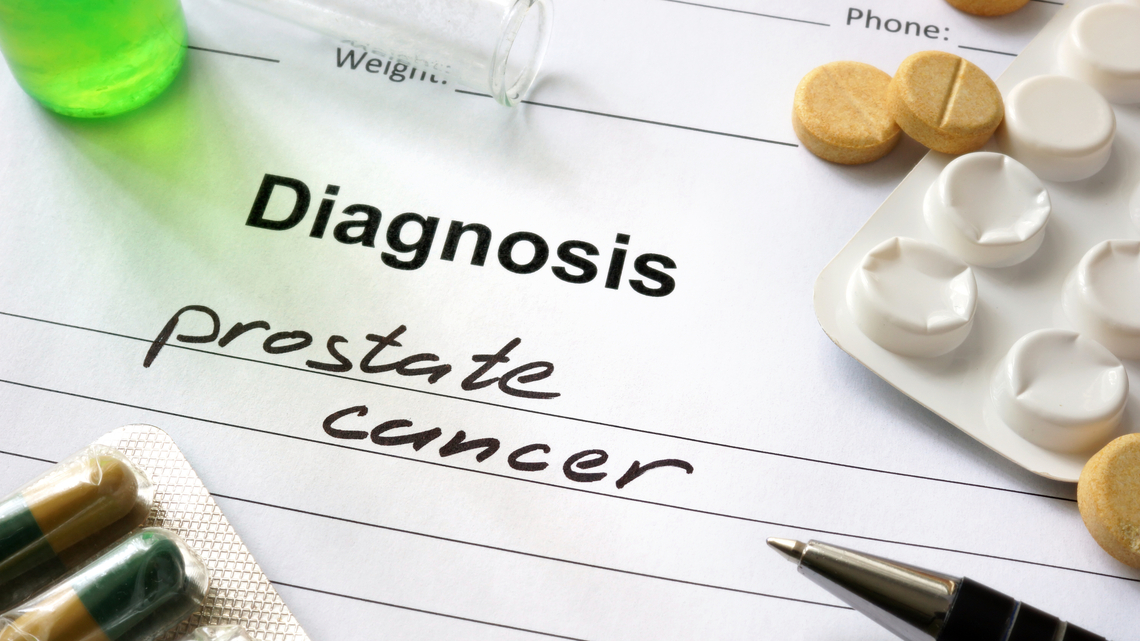 New prostate cancer imaging outperforms biopsies for diagnosis 