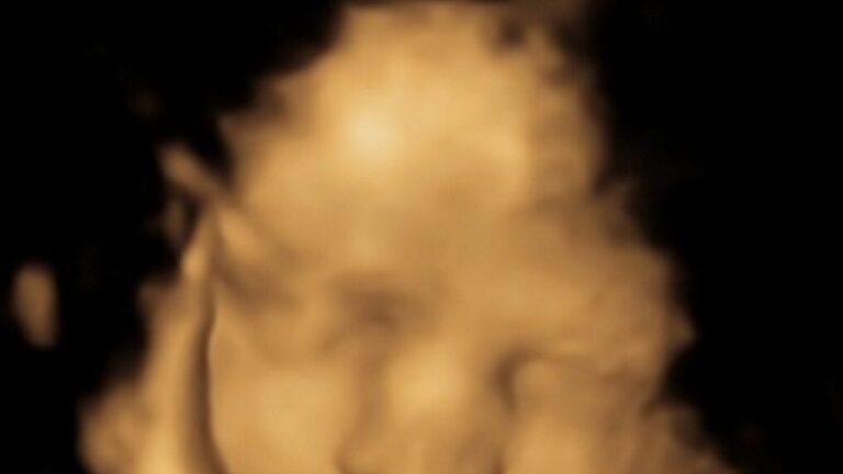 Scientists discover toddlers can remember smells from the womb