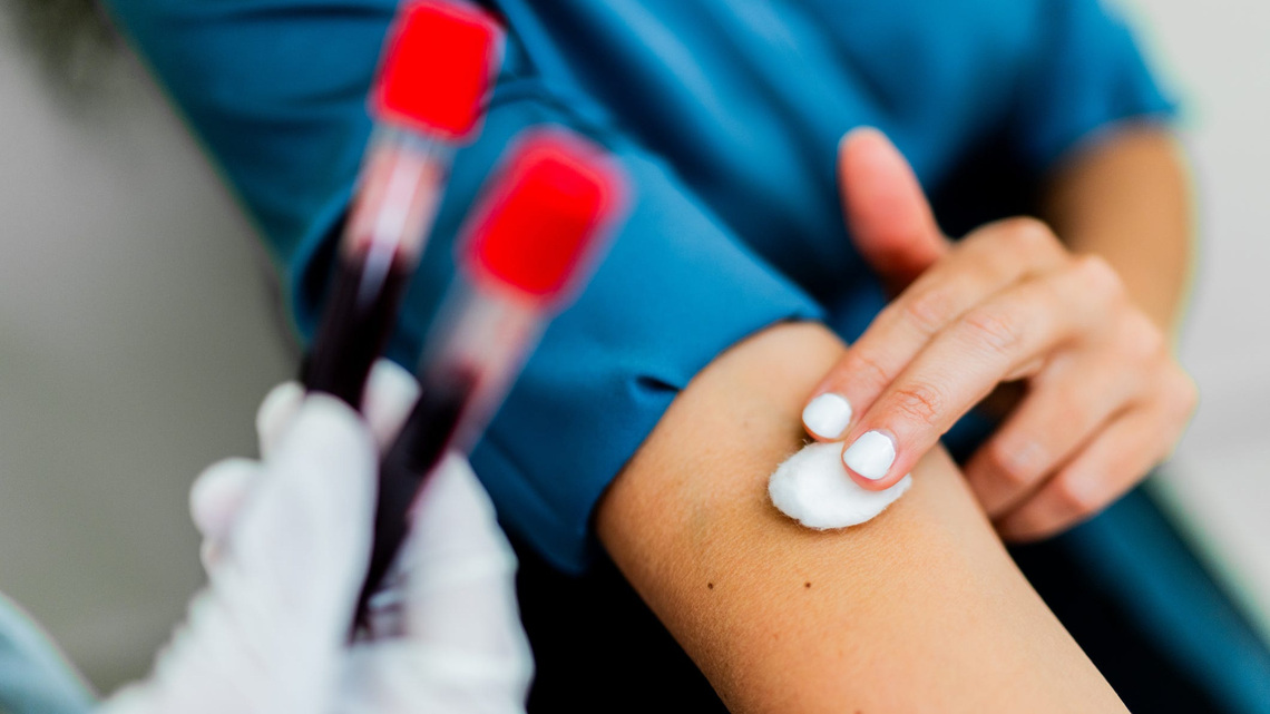 Louisville doctor vetted new blood test that screens for 50+ cancers