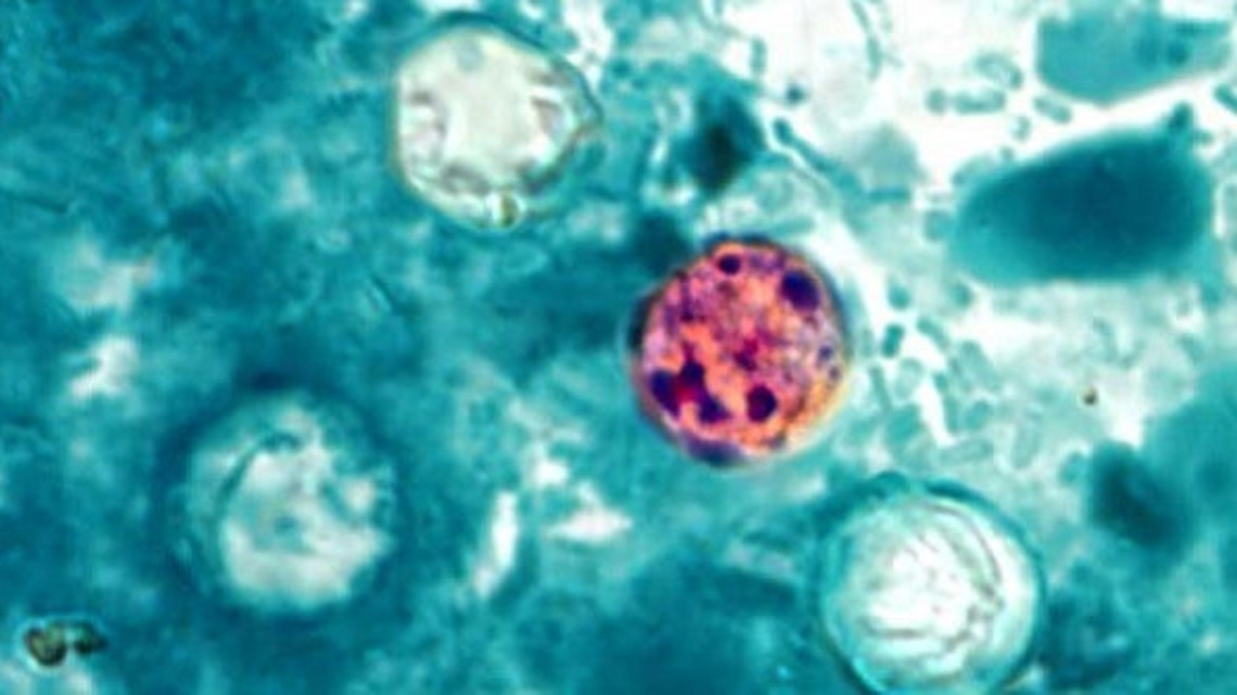 FDA backtracks on Taylor Farms cyclospora lettuce test, California firm notes ‘mistake’