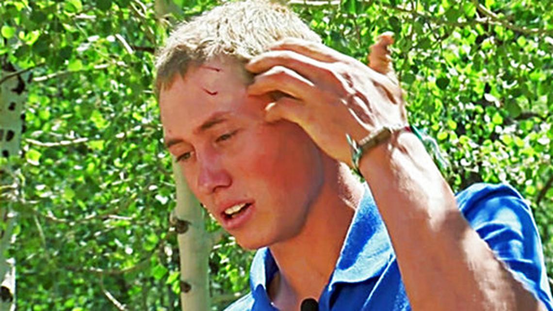 Dylan McWilliams, 20, of Colorado, woke up to a bear biting down on his skull while camping in July 2017. Almost one year later, he  was bitten by a shark in Hawaii. The outdoor man has also recently been bitten by a rattlesnake.