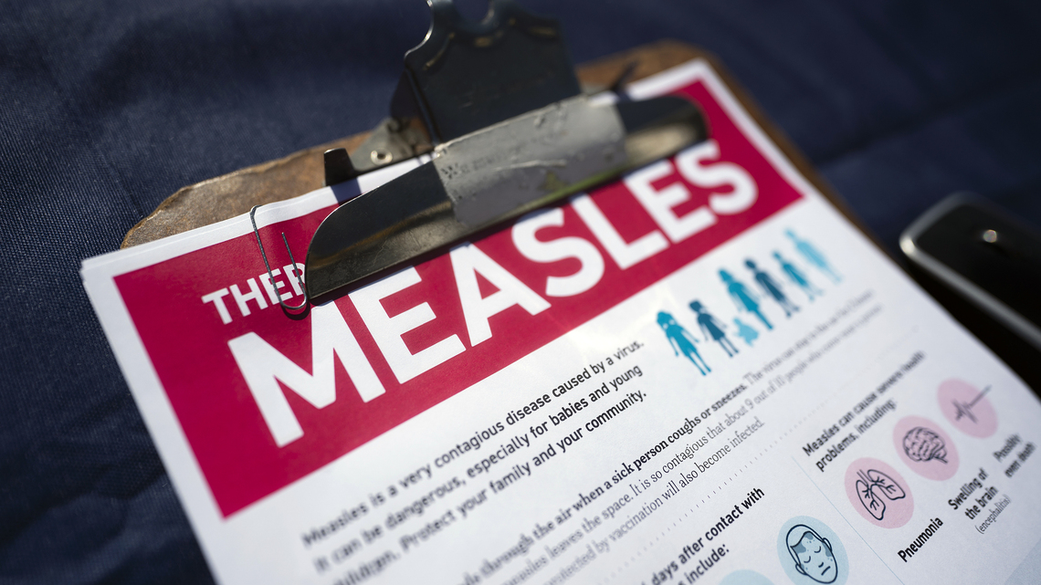 Maryland confirms 2 measles cases tied to out-of-state travel 