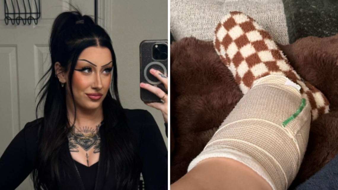 Woman, 26, Thought Her Leg Was Just Itchy, Then Came Nightmare Diagnosis 