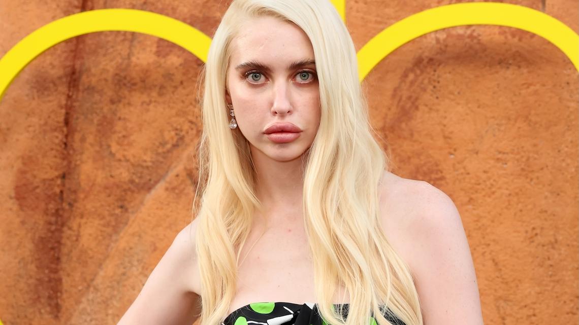 Euphoria's Chloe Cherry Opens Up About Getting ‘So Much Lip Filler' and Botox 