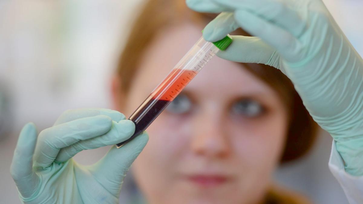 A blood test can predict the risk of dementia in women up to 25 years before symptoms appear, researchers say. (Patrick Seeger/dpa/TNS)