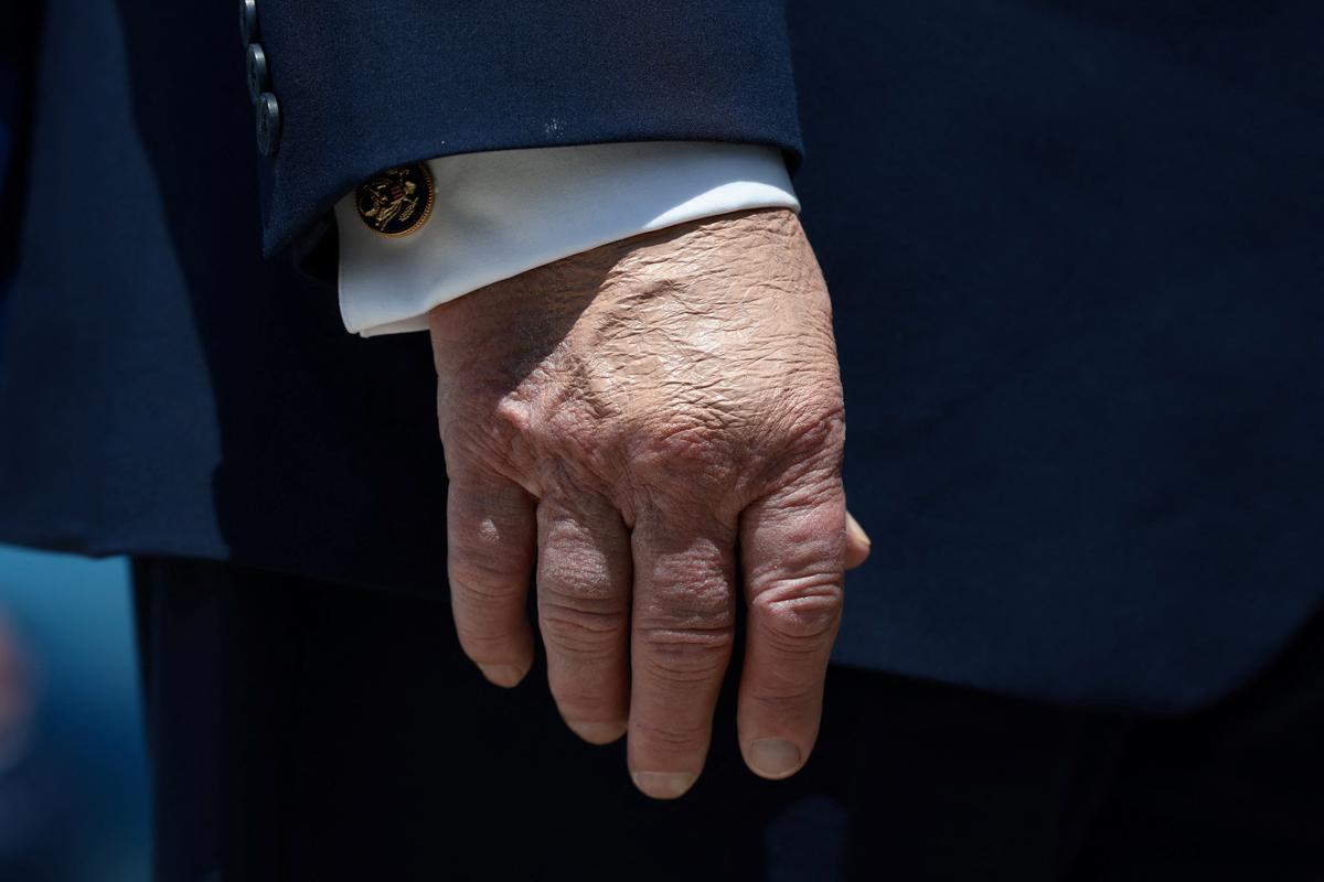 Make-up partially covering U.S. President Donald Trump's hand as he arrives at Joint Base Andrews in Maryland, U.S., May 20, 2026. REUTERS/Evelyn Hockstein