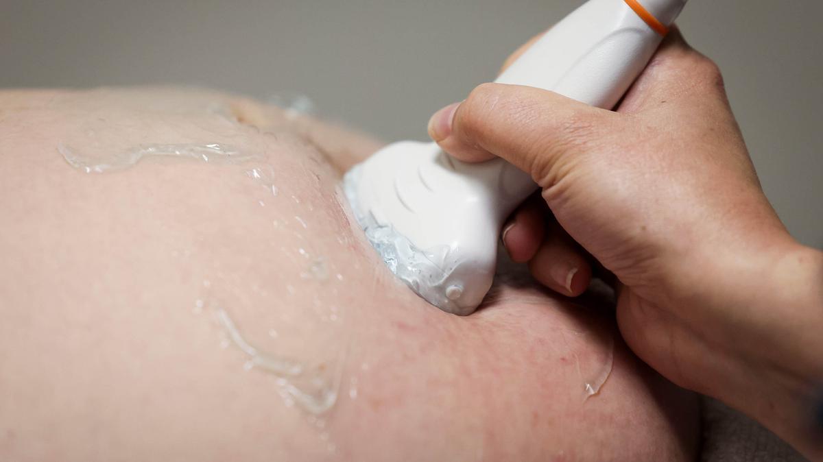 A doctor performs an ultrasound on a pregnant woman. (Shafkat Anowar/The Dallas Morning News/TNS)
