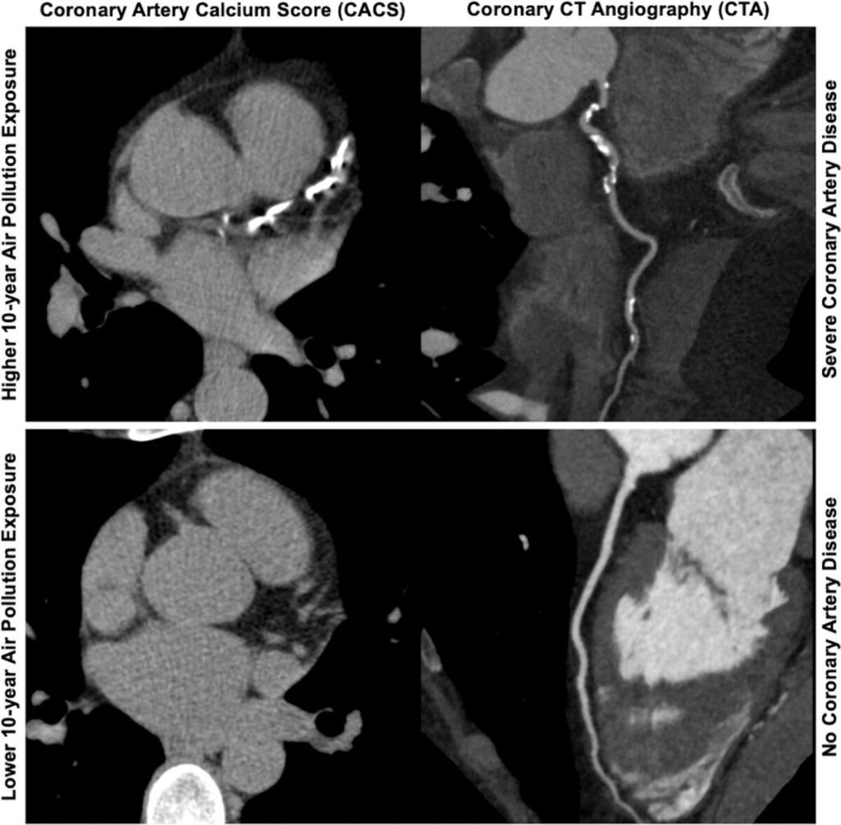  (University of Toronto / Radiology via SWNS) 