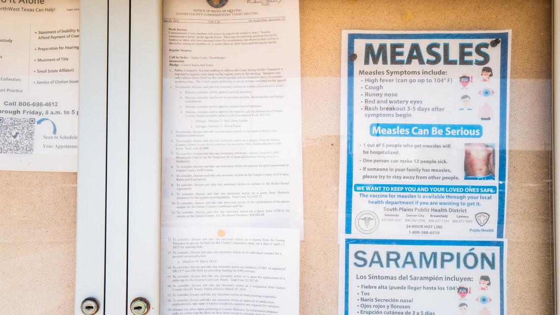 California sees the most measles cases in 7 years as disease resurges nationwide 