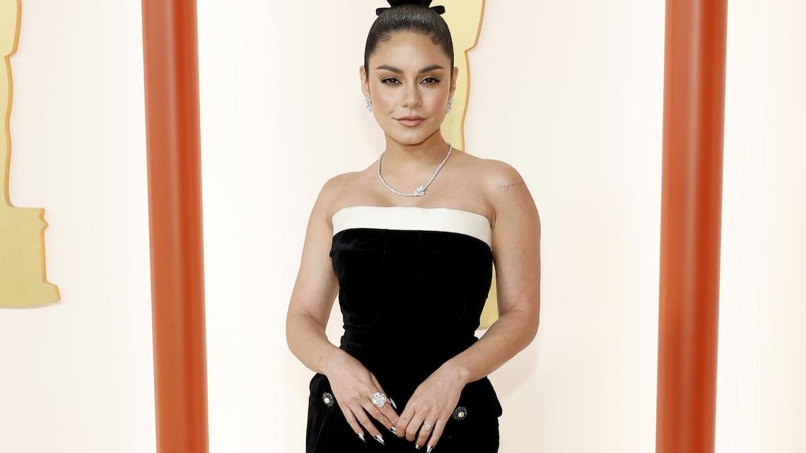 Vanessa Hudgens Shares Postpartum Hair Loss After Welcoming Baby No. 2 