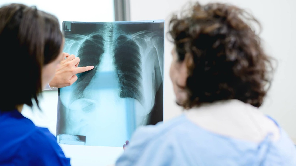 Registered Dietitians Are Begging People To Do This One Thing To Prevent Bone Loss 