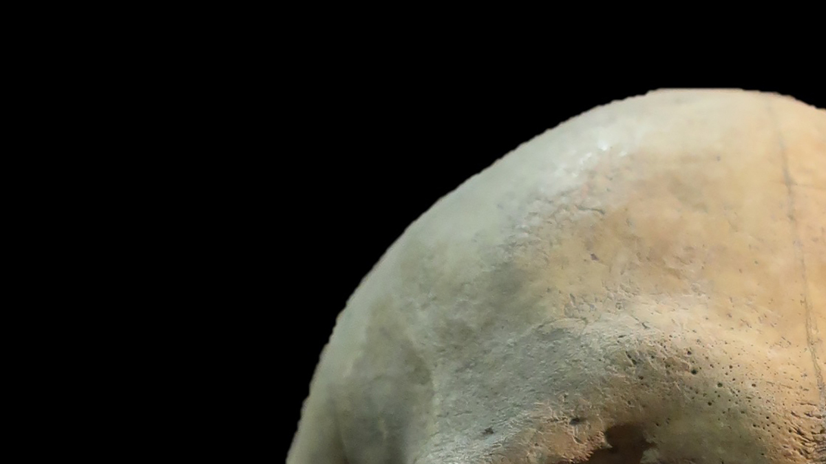 Molar DNA was extracted from the skull of an adult woman, estimated to be 25 to 35 years old, who was a plague victim. In ancient Siberian graves, scientists have discovered the oldest traces of one of humanity's greatest enemies.