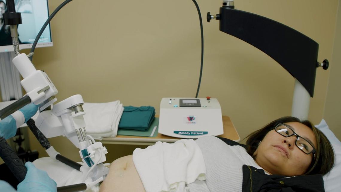 Alabama's ‘pretty cool' plan for robots in maternity care sparks debate 