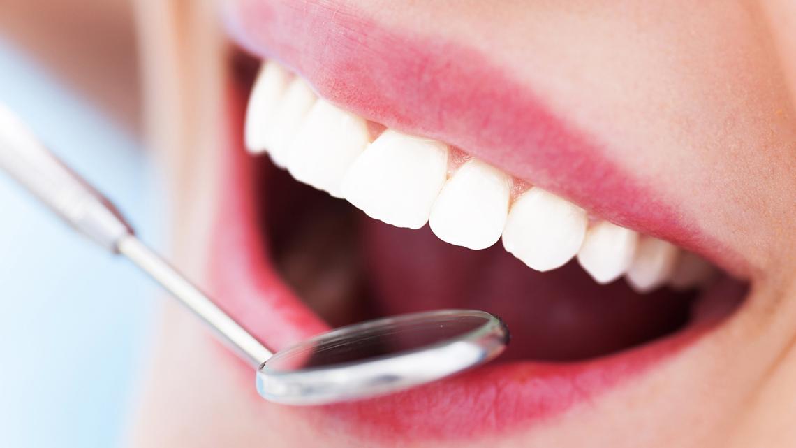 University of Minnesota research counters claims that fluoride in water lowers IQs 