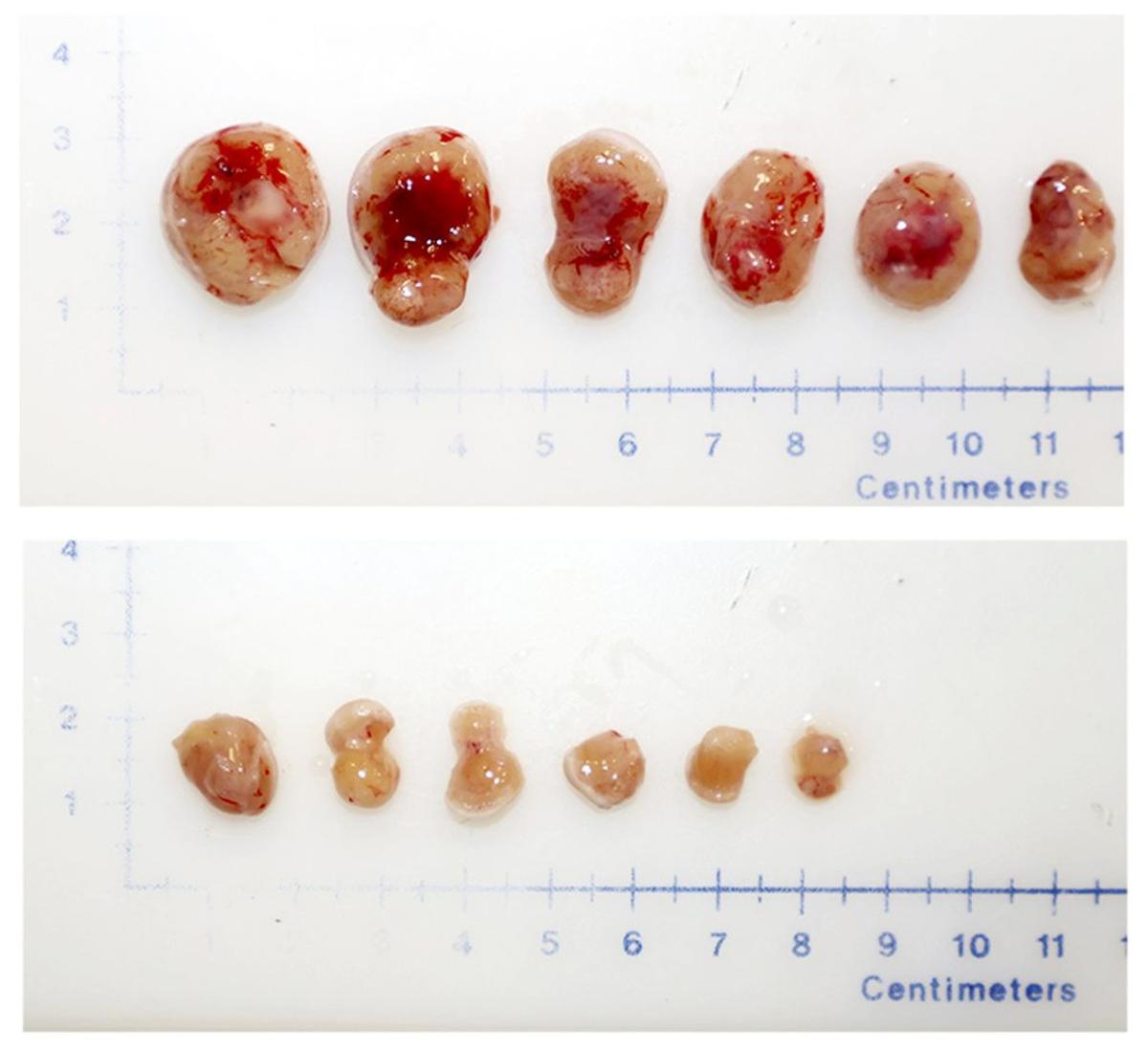  Tumors surgically removed from Sirt1-silenced mice (bottom) are significantly smaller than tumors removed from mice with wild-type Sirt1 expression. (Nunes de Almeida et al via SWNS) 