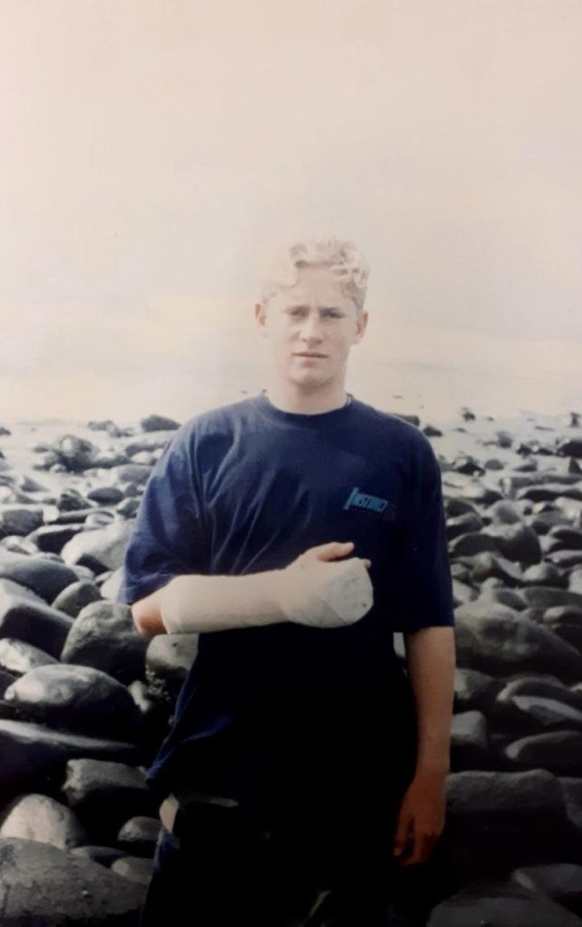  Shannon Ainslie in his teens wearing a cast. (Courtesy of Shannon Ainslie via SWNS) 