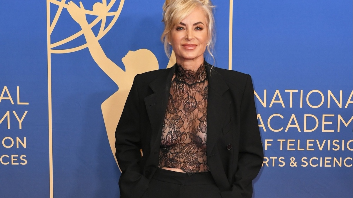 Eileen Davidson von RHOBH zeigt schwere Knieverletzung nach einem Unfall ...