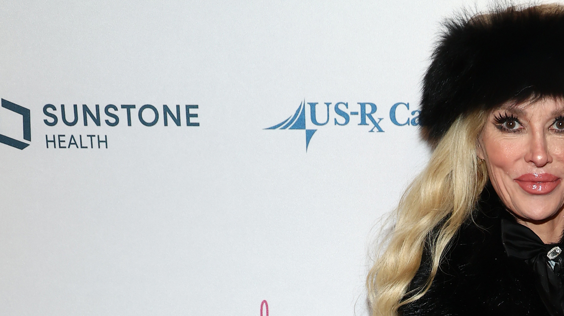 Brandi Glanville Has ‘Benign Tumor' After Return of Her Facial ‘Parasite' 