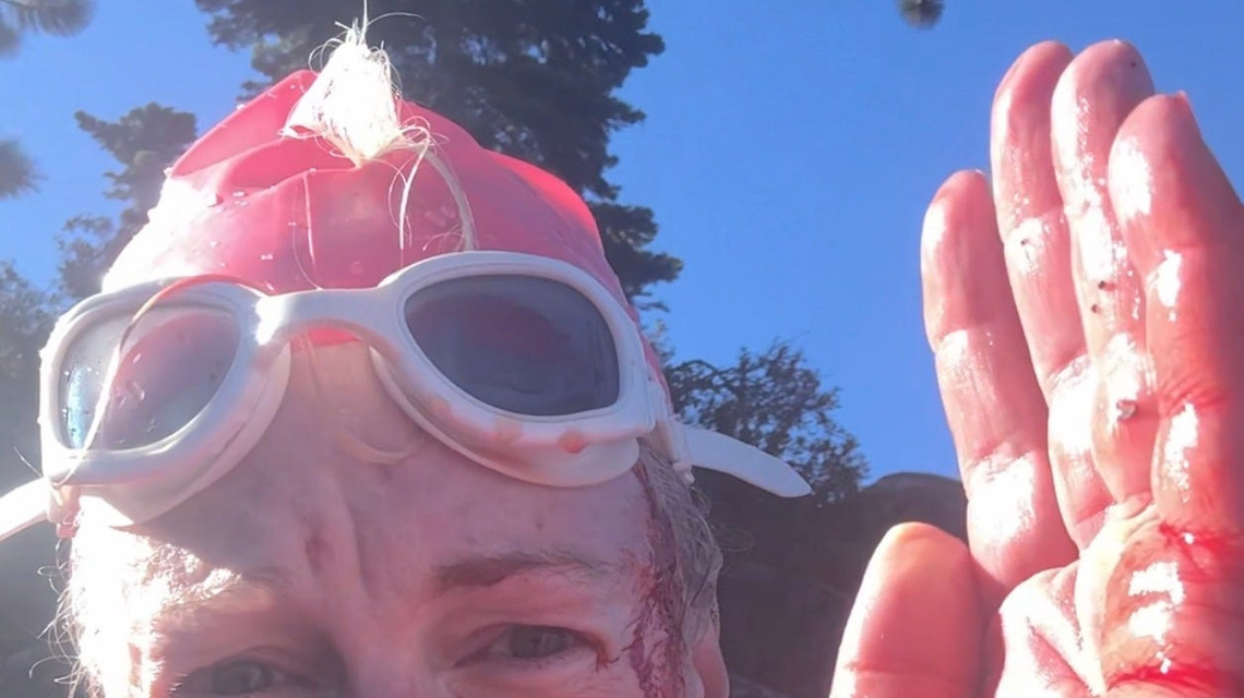 A woman was swimming in Lake Tahoe. Then she 'felt the teeth and claws' 