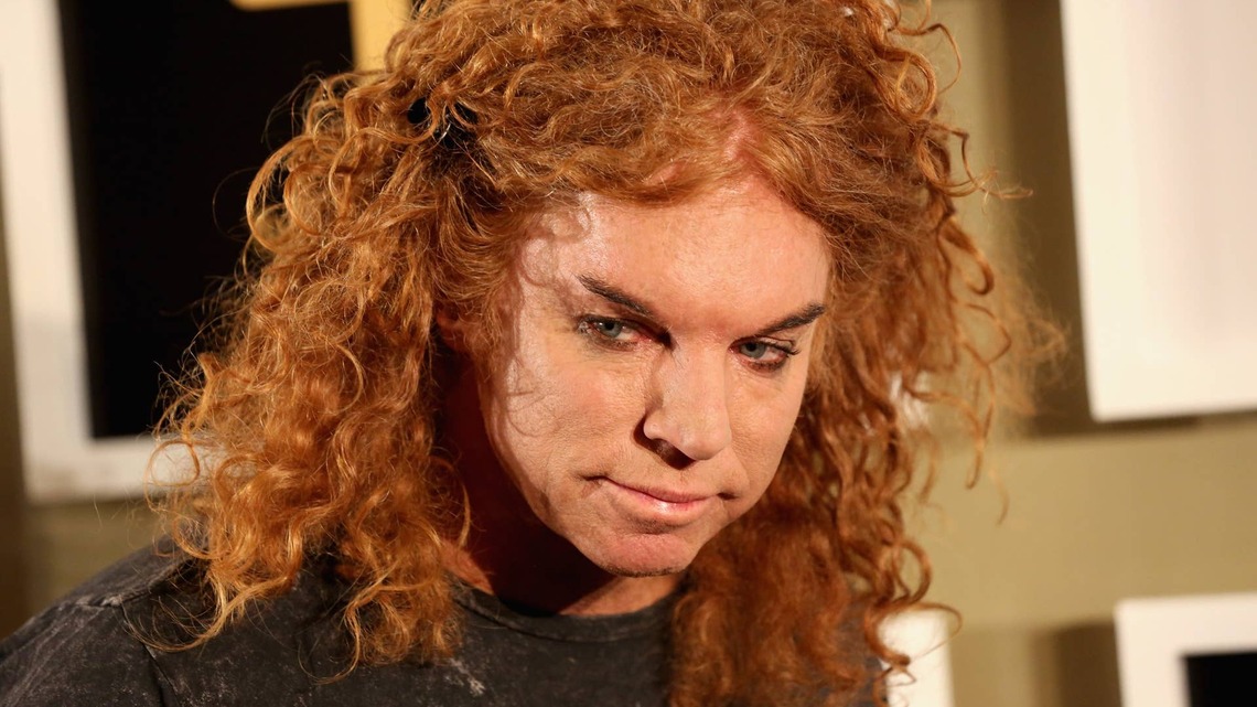 Carrot Top Spotted at Church in First Public Outing Since Hospitalization 