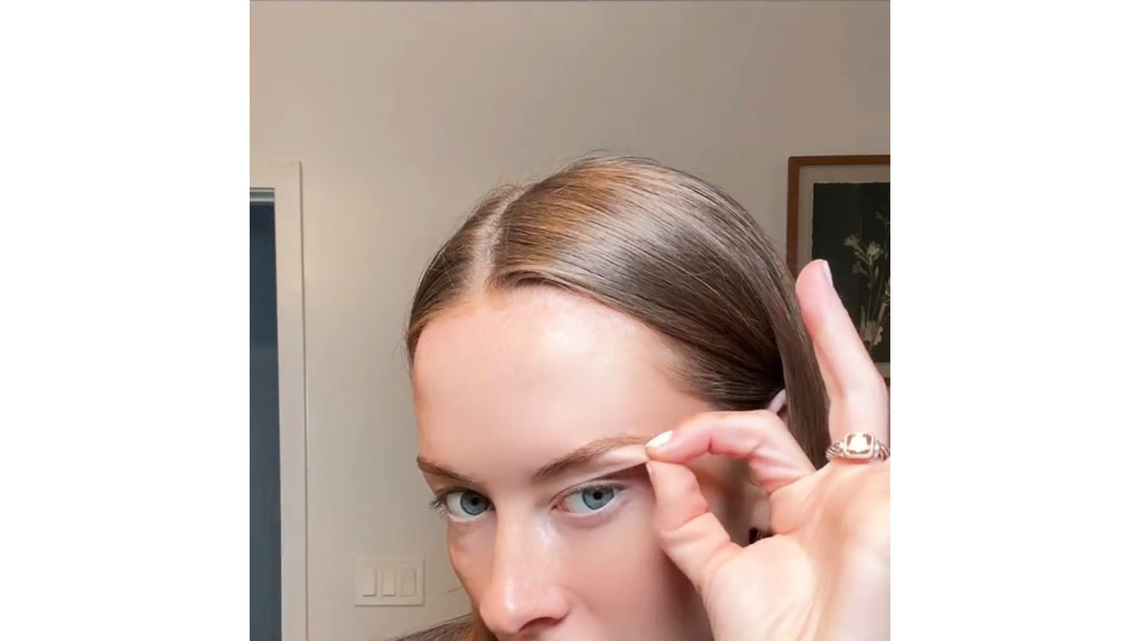 I want plastic surgery work done on my eyes. What are the concerns?