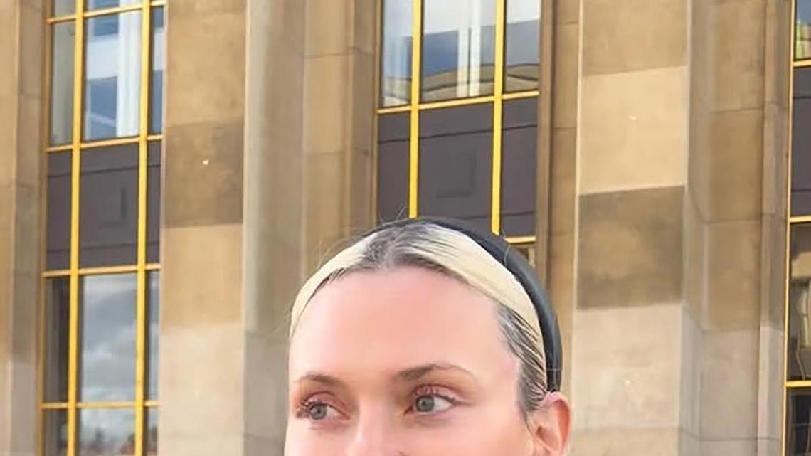 Art Influencer Found Dead Inside Brazilian Hotel After Cosmetic Surgery 