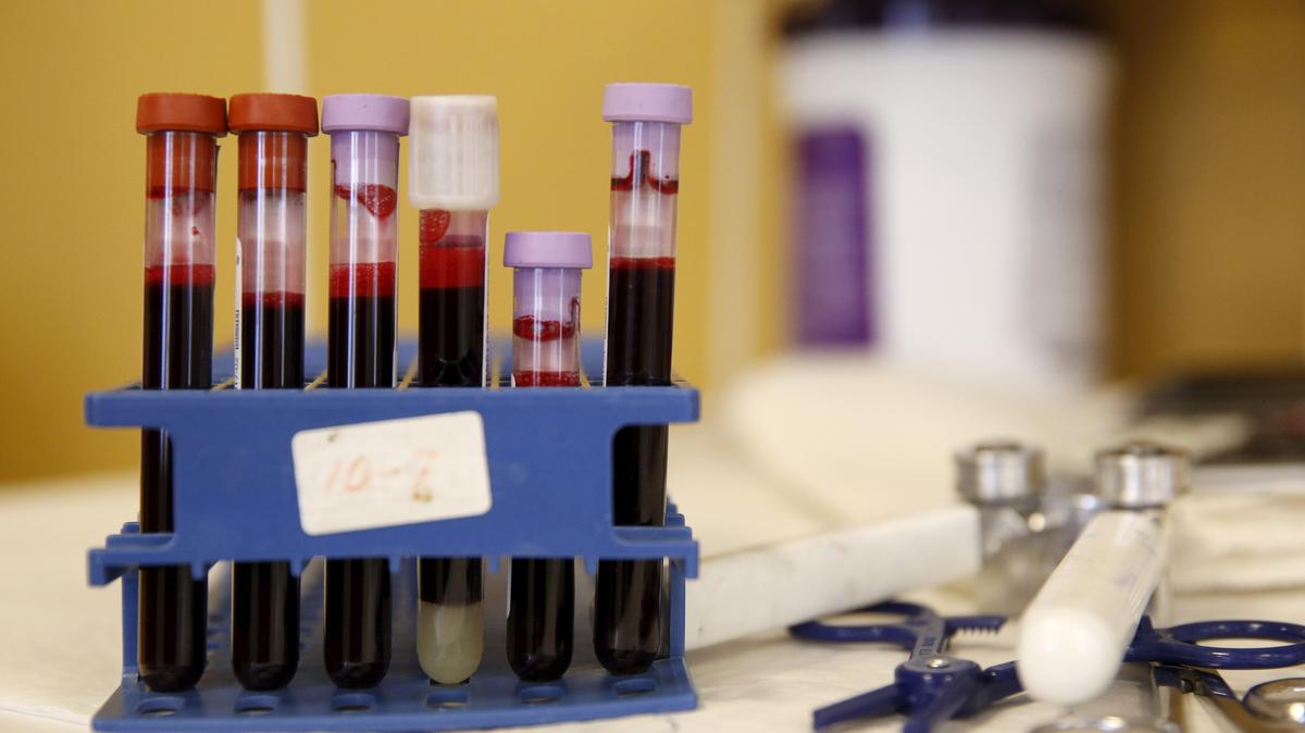 FILE PHOTO: Testing tubes full of blood are seen in Washington, U.S., February 16, 2016. REUTERS/Gary Cameron