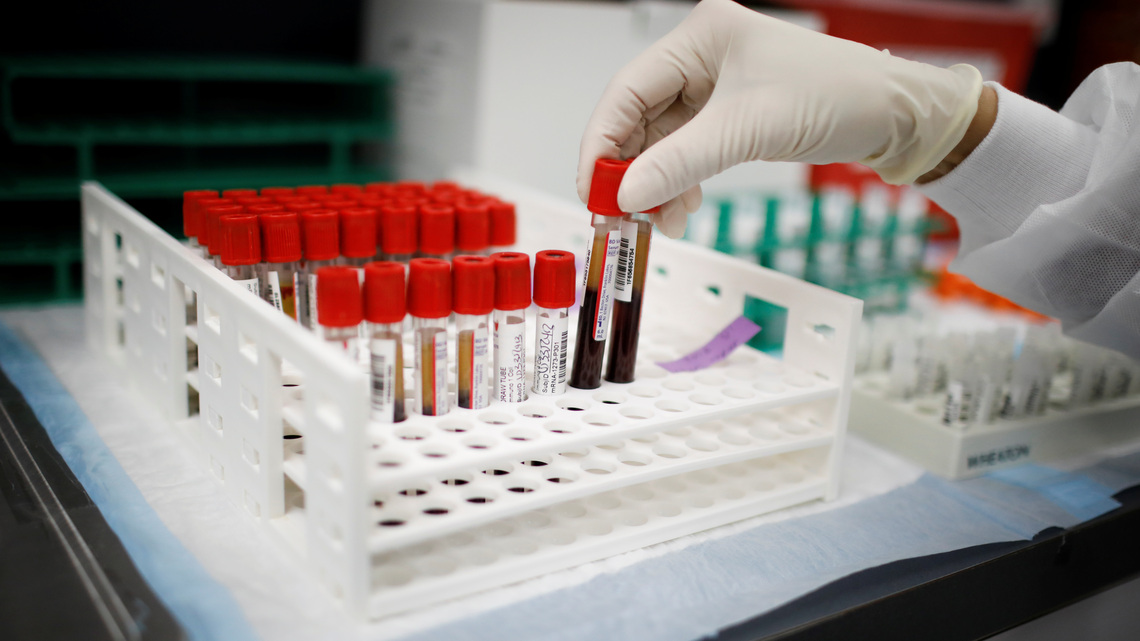 Health Round: Experimental blood test finds high-risk colorectal lesions before cancer develops 