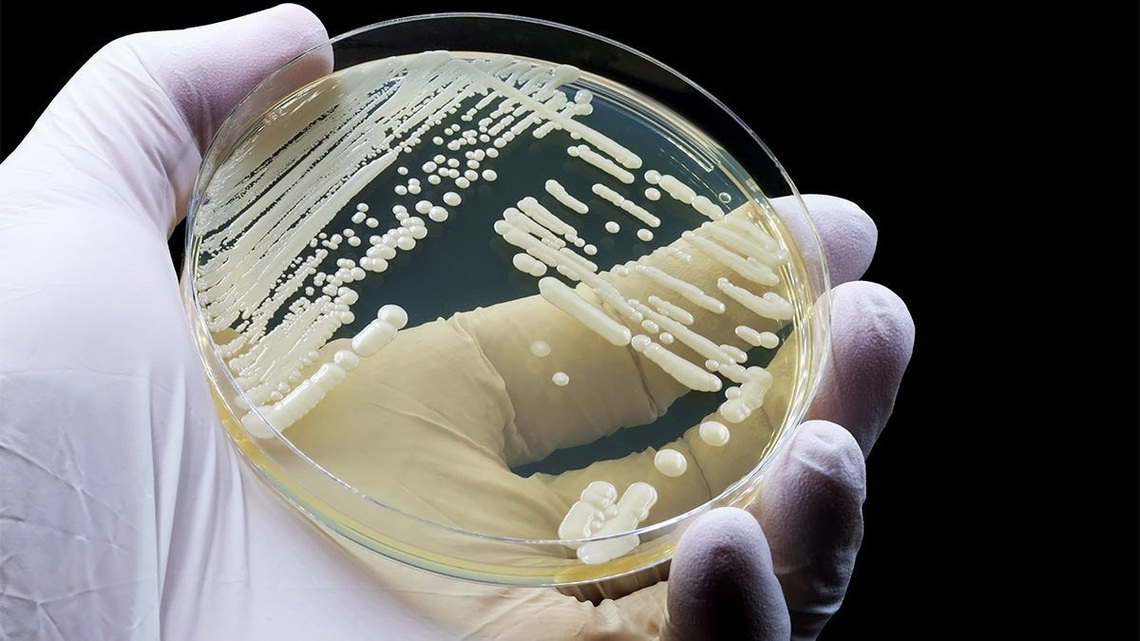 Deadly drug-resistant ‘superbug’ is spreading in California. What to know