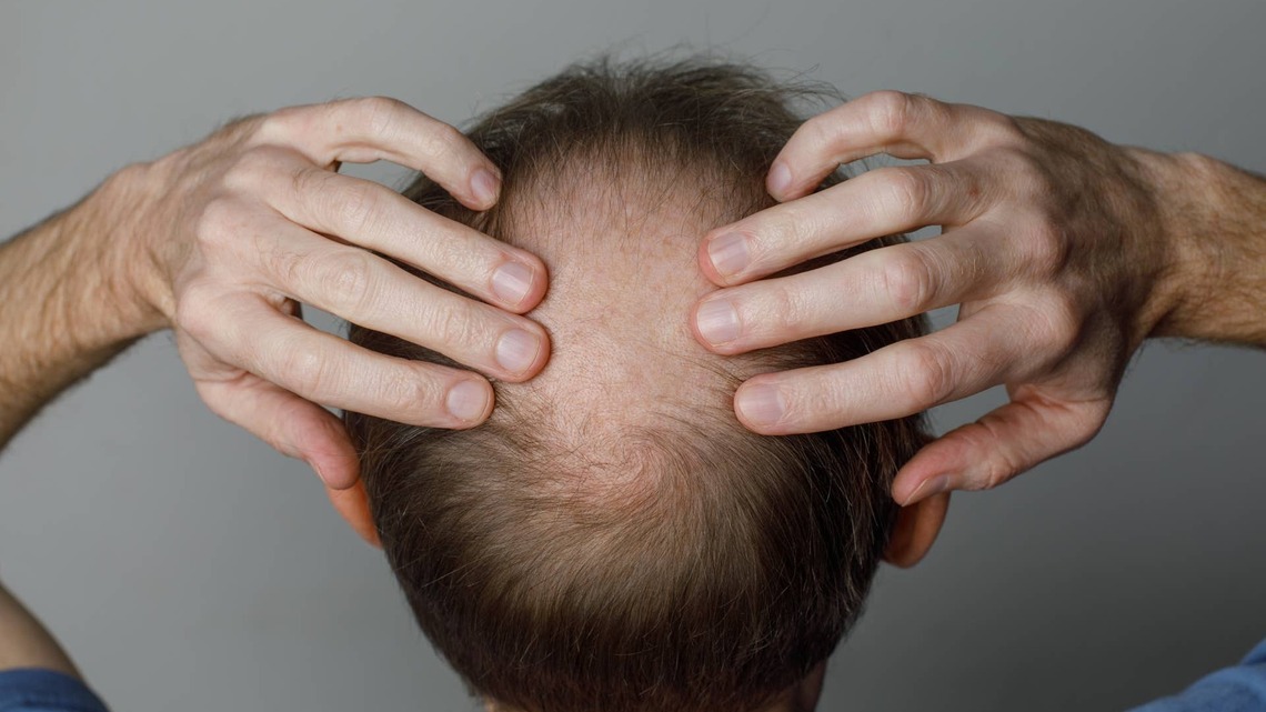 Red Light Therapy May Help Men Fight Hair Loss, Here's What the Science Says