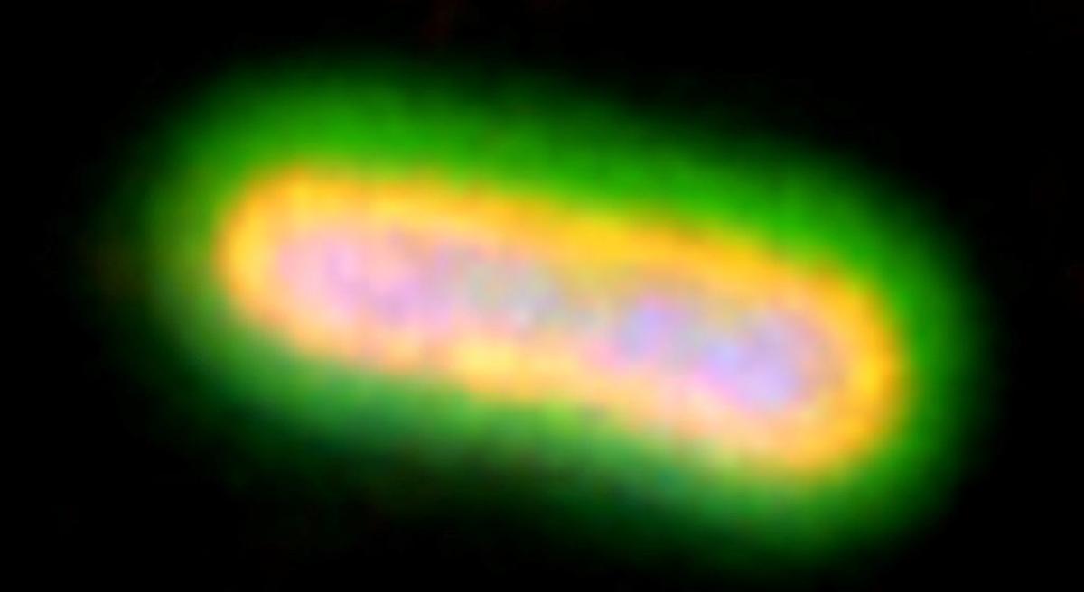  A hypervirulent and pan-resistant strain of Klebsiella pneumoniae stained with monoclonal antibodies against the capsule (green) and the O-antigen (yellow). (Rino Rappuoli via SWNS) 