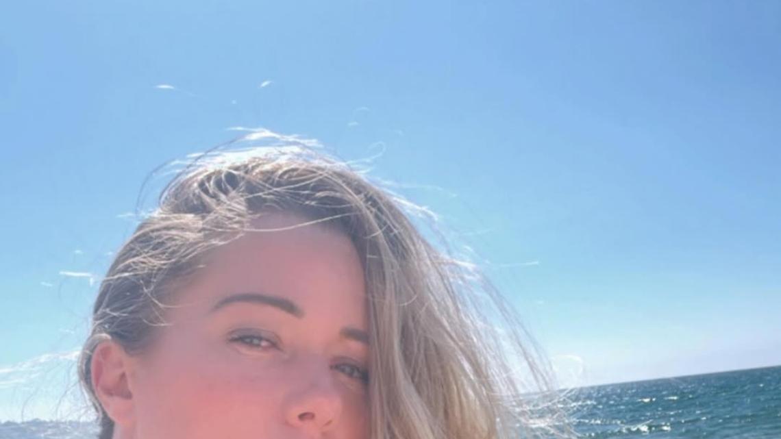 Kendra Wilkinson Is Happy ‘Losing the Pervert' Audience on Her Social Media 