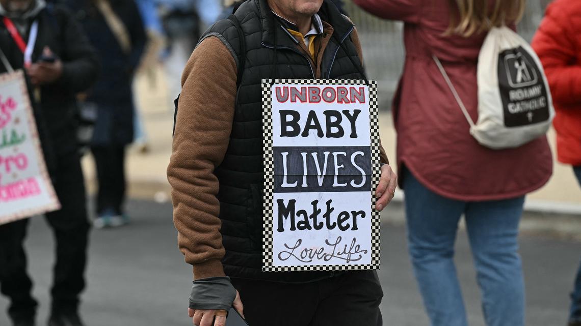 A person wears a "Baby Lives Matter" sign as they attend the 53rd annual March for Life rally in Washington, D.C., on Jan. 23, 2026. The annual pro-life demonstration, themed "Life is a Gift," marks the anniversary of the Roe v. Wade decision and includes a march toward Capitol Hill. (Saul Loeb/AFP via Getty Images/TNS)