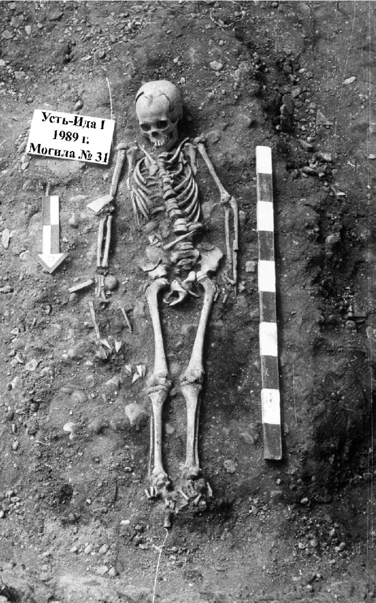 The body of a hunter-gatherer boy estimated to have been 10-12 years old who was found to have been infected with plague and was buried in a grave excavated in the vicinity of Lake Baikal in Siberia roughly 5,500 years ago, seen in this 1989 photograph released on June 17, 2026. Vladimiri Bazaliiskii/Handout via REUTERS