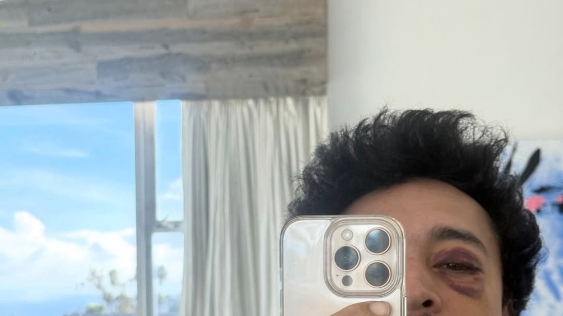 Olympic Skateboarder Nyjah Huston Fractures Skull After ‘Death Defying' Stunt 