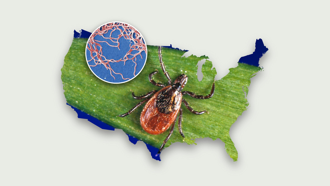 Lyme-Carrying Ticks are moving South, CDC warns. ER visits could rise 