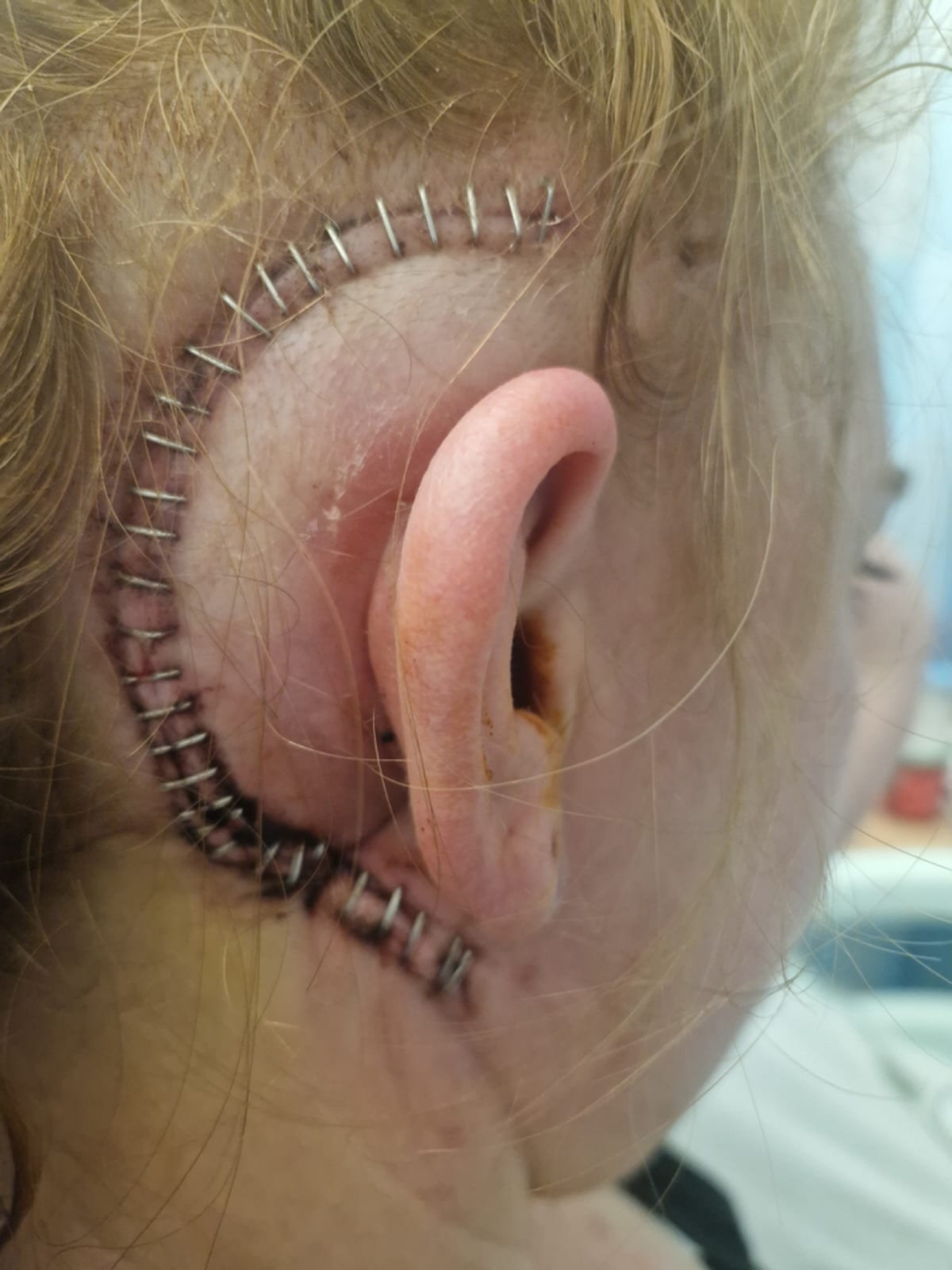  (Brain Tumour Research via SWNS) 