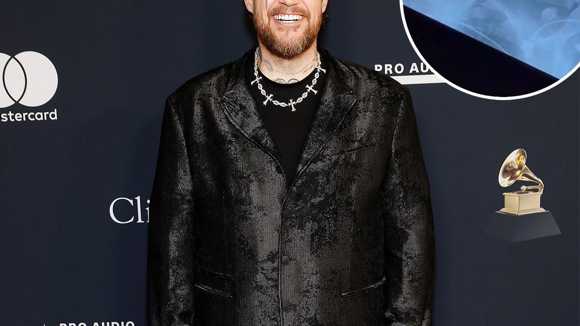 Jelly Roll Reveals He Hid an Injury at the 2026 Grammys: 'Wanted to Scream' 
