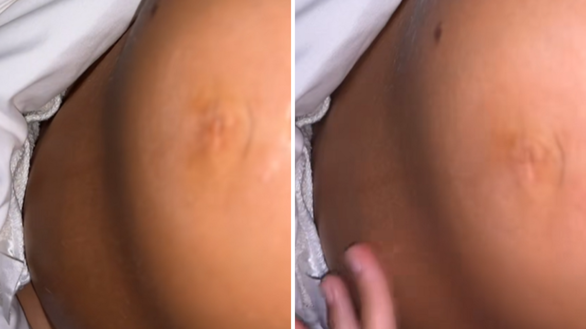 Mom-to-Be Panics at What's Seen on Pregnancy Bump-Then Doctors Reveal Truth 