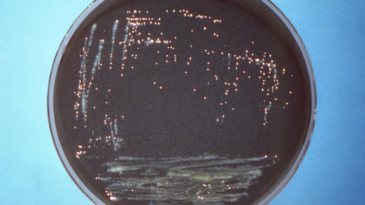 Legionella pneumophila, the bacterium that can cause Legionnaires’ disease. (Centers for Disease Control and Prevention/TNS)