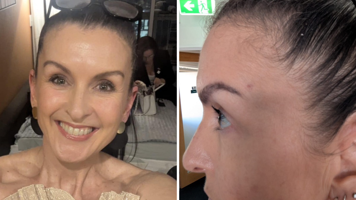 (L-R) Simone Trainor smiling, captured in a soft side‑profile that highlights the spot above her eyebrow. 