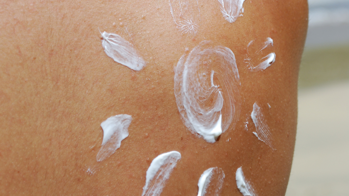 Mayo Clinic Q&A: What do I need to know about skin cancer protection?