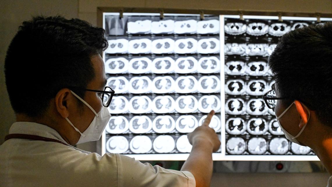 Vietnamese doctor Truong Duc Thai and his colleague checking X-ray film of a drug-resistant tuberculosis patient at National Lung Hospital in Hanoi.  (Nhac Nguyen/AFP/Getty Images/TNS)