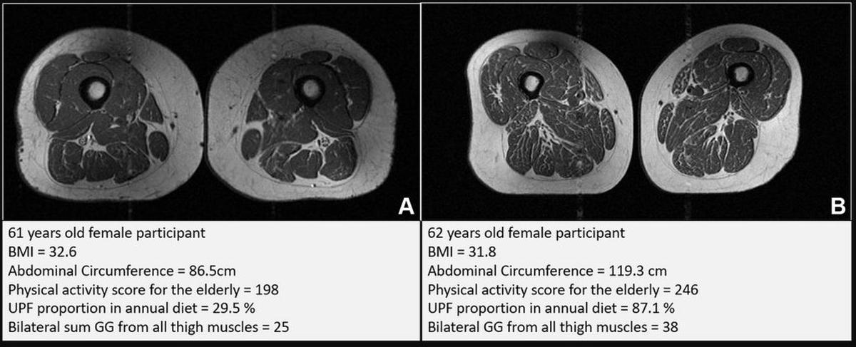  (University of California, San Francisco / Radiology via SWNS) 
