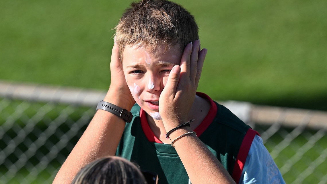 Skin Cancer Is the Most Common Cancer in the U.S. Here’s How Families Can Protect Their Skin
