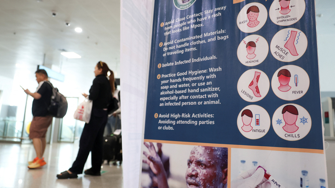 Nigeria's Ebola patient medically evacuated to Switzerland 